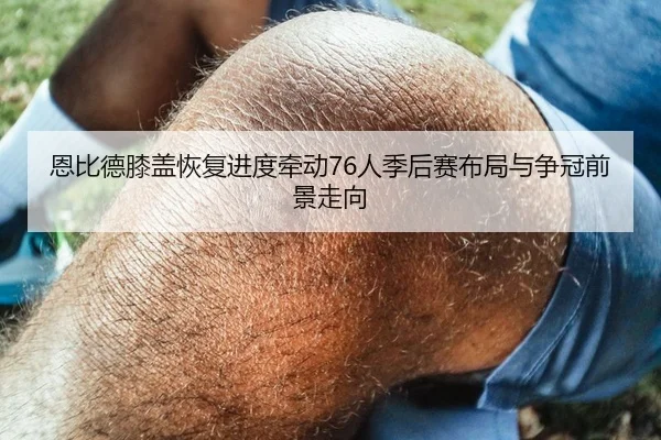 恩比德膝盖恢复进度牵动76人季后赛布局与争冠前景走向 - kaiyun